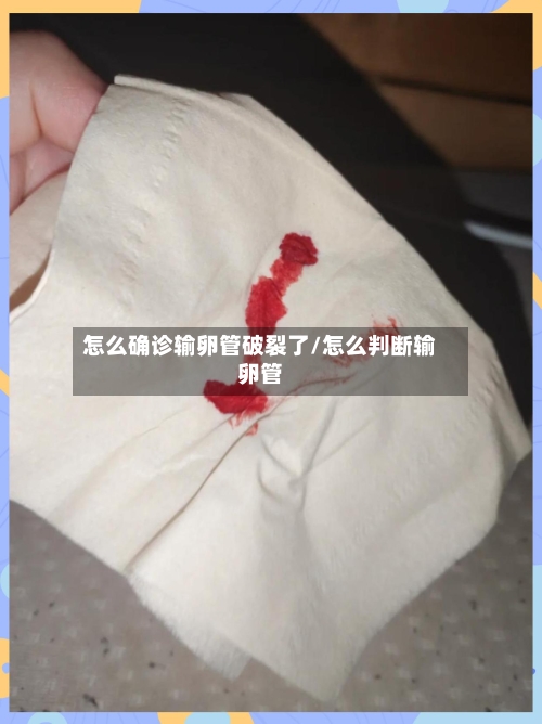 怎么确诊输卵管破裂了/怎么判断输卵管-第3张图片