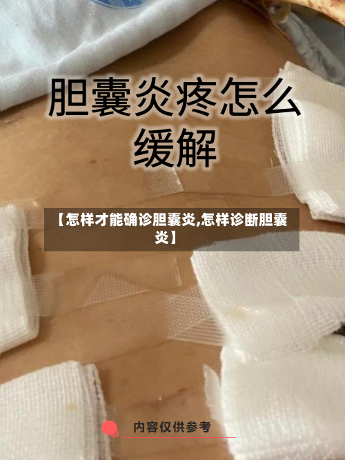 【怎样才能确诊胆囊炎,怎样诊断胆囊炎】-第3张图片