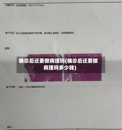 确诊后还要做病理吗(确诊后还要做病理吗多少钱)-第3张图片