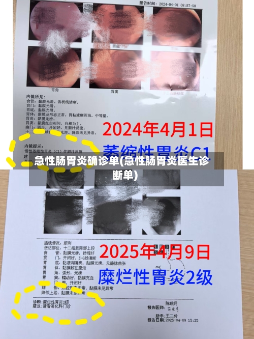 急性肠胃炎确诊单(急性肠胃炎医生诊断单)