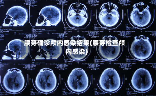 腰穿确诊颅内感染结果(腰穿检查颅内感染)