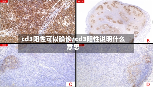 cd3阳性可以确诊/cd3阳性说明什么意思